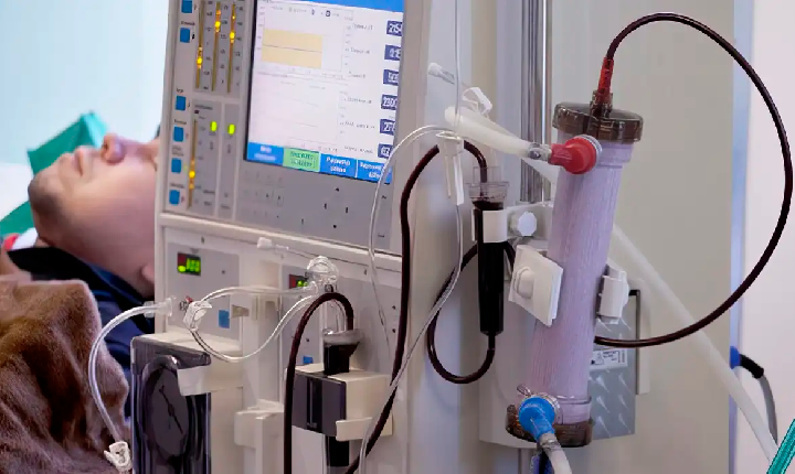 Estudo alerta para subdiagnóstico da doença renal crônica no Brasil