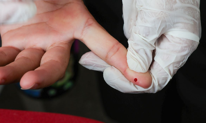 SUS passa a oferecer teste rápido de dengue